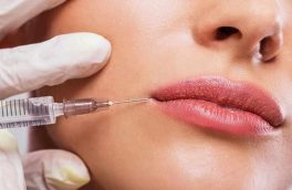 تزریق ژل به لب چگونه است و چقدر ماندگاری دارد؟