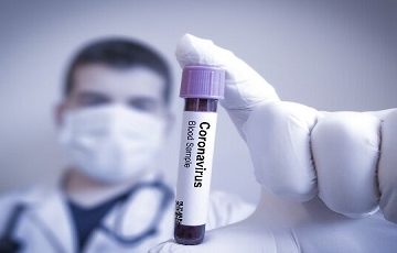 ۴۵ مازندرانی در جشن و مهمانی خانوادگی به کرونا مبتلا شدند