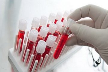 نجات یک زندگی با اهدای سلول بنیادی